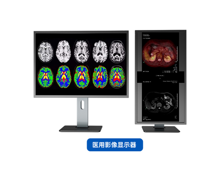 医用影像显示器+数字人健康助手+个人健康管理平台